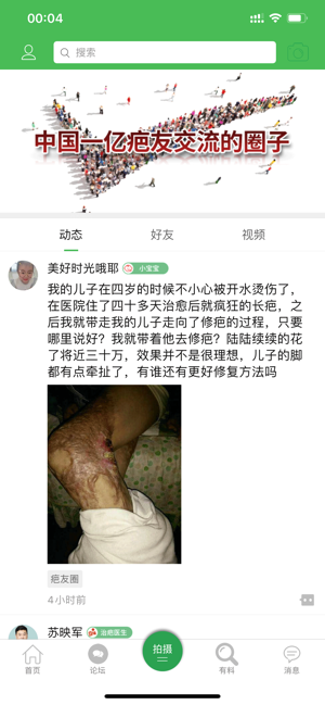 中国疤痕论坛手机版